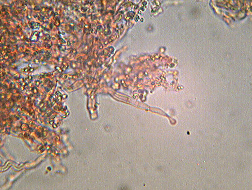 Hyphoderma sambuci